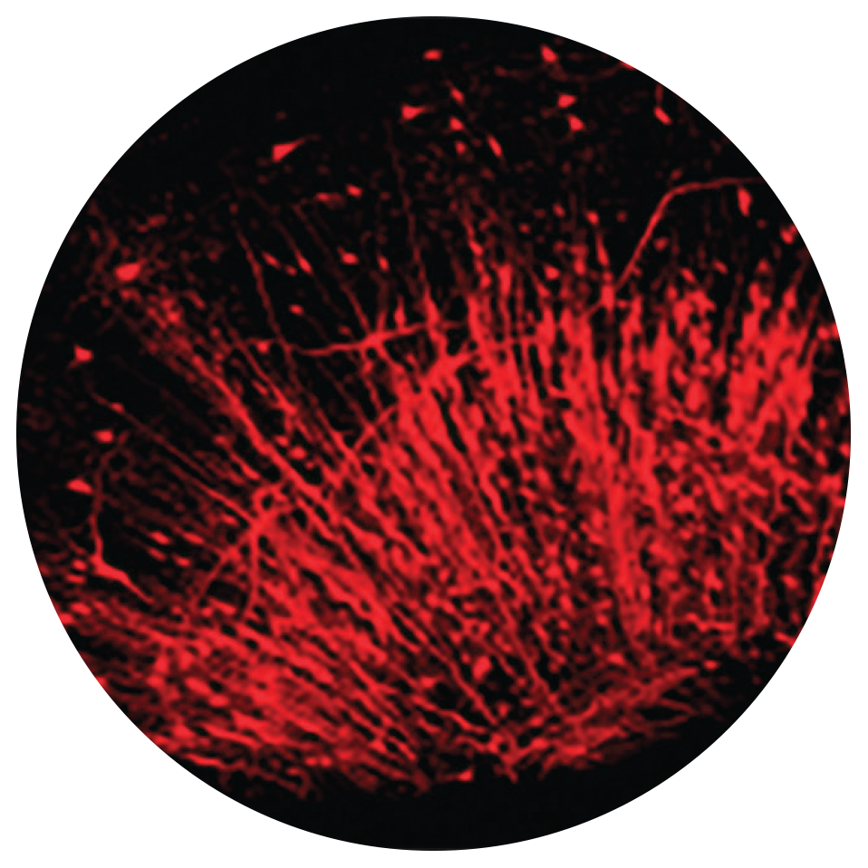 sample from a Leica SP8 STED 3X Super-Resolution STED (STimulated Emission Depletion) Confocal Microscope.